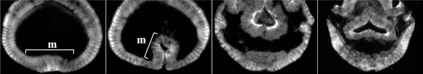 Expression of DE-cadherin during Drosophila gastrulation